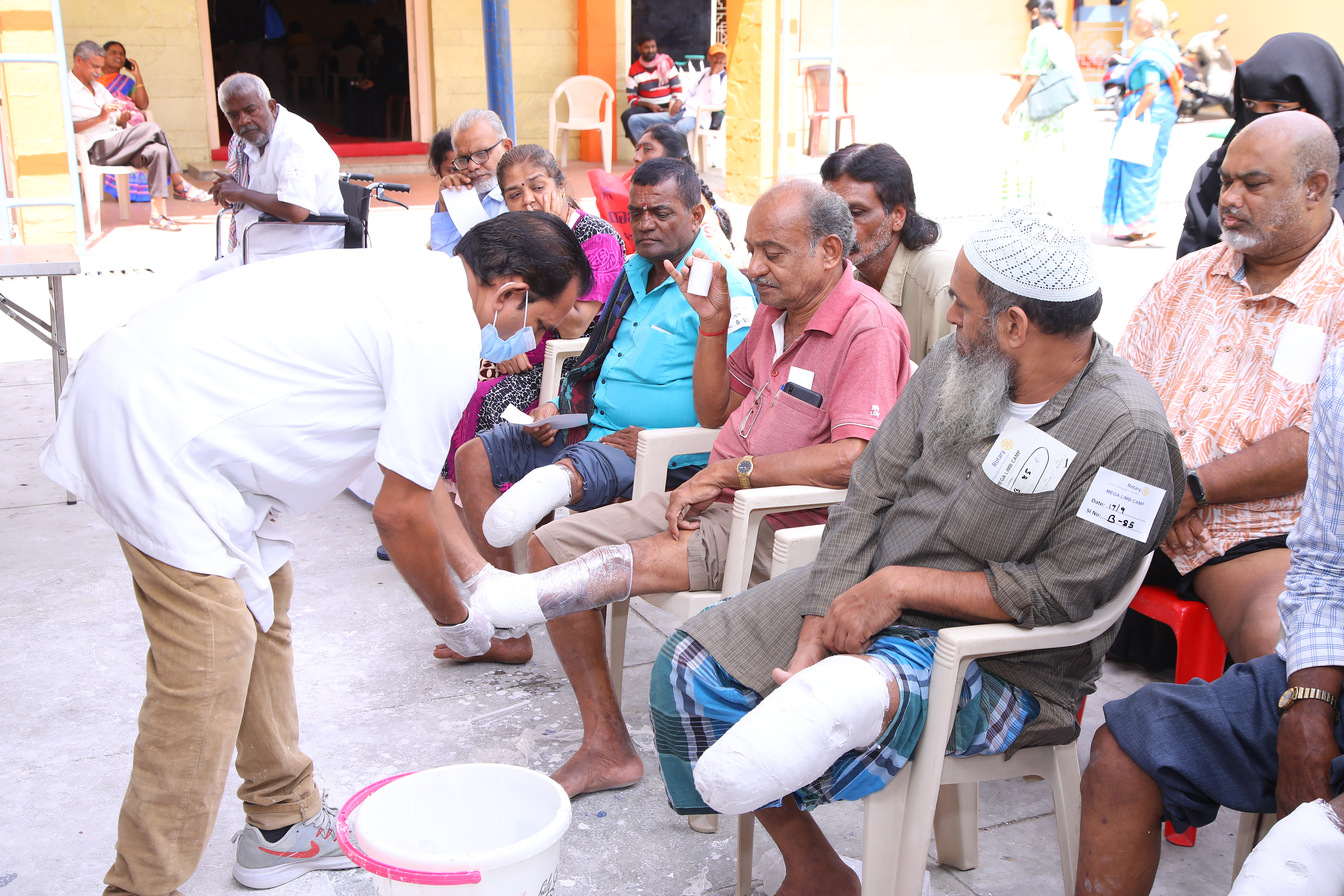 Distribution of Free Artificial Limbs